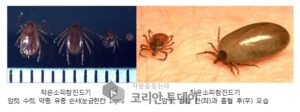 충남서 올해 진드기 감염병으로 첫 사망자 발생