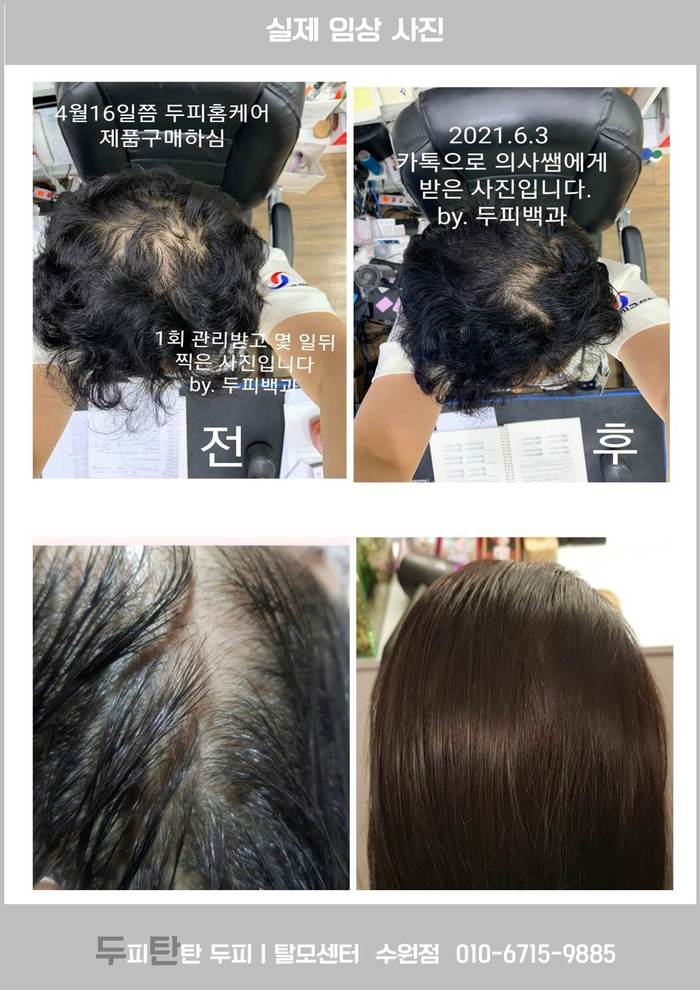 ❤ 수원탈모관리 두피탄탄 두탄 수원점 오픈 소식과, 7월31일까지 파격 오픈 이벤트를 진행 소식. . ❤