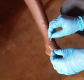 WHO Report Highlights Slow Progress in Preventing Healthcare-Associated Infections