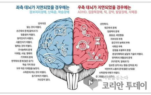 [코리안투데이] 좌뇌 우뇌의 균형 © 임명희 기자