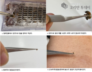 [벌침요법_06] 벌침요법의 놀라운 효능, 우리 몸이 바뀐다