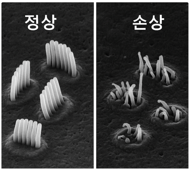[코리안투데이] 정상 유모세포와 손상된 유모세포 비교 © 지승주 기자